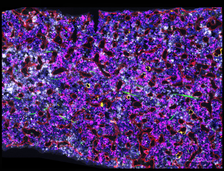 Image shows gene cells as seen through a microscope.